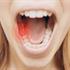 دلیل درد یهویی دندان چیست؟